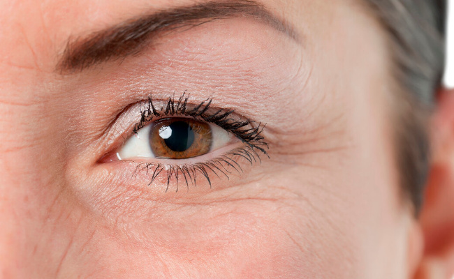 ​怎样快速去掉眼角纹  怎么预防眼角纹