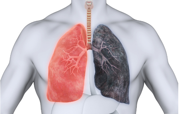 吃什么净化肺和呼吸道  净化肺和呼吸道有什么好处