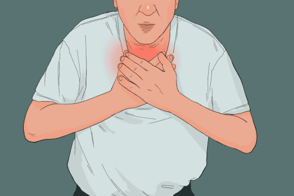 心肌梗塞有什么症状表现  心肌梗塞的症状有哪些